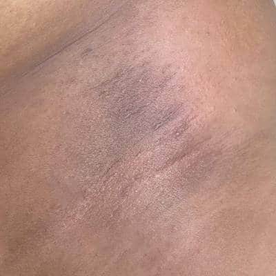 BODY WAXING