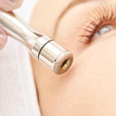 MICRODERMABRASION